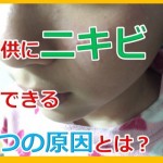 突然、子供の顔にニキビが17個もできた!原因は一体何なんだ?