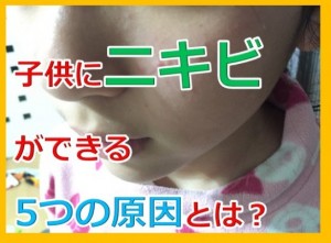突然、子供の顔にニキビが17個もできた！原因は一体何なんだ？