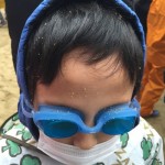 知ってる?子供の顔ニキビを予防するために必要な5つのケアとは?